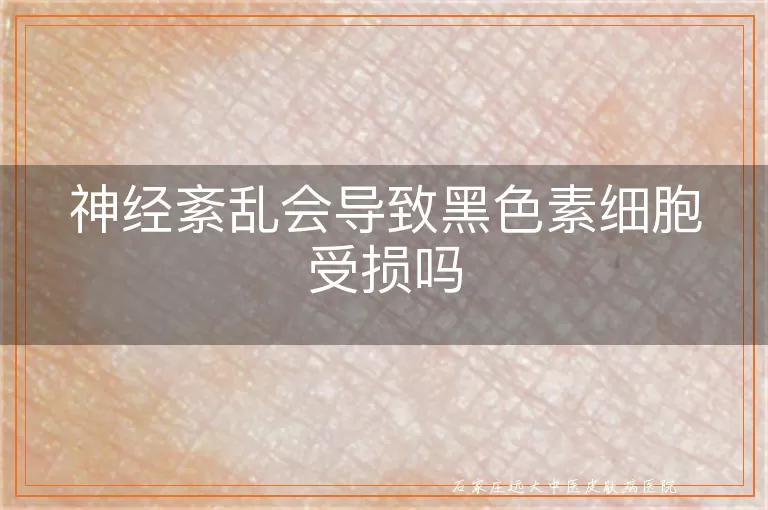 神经紊乱会导致黑色素细胞受损吗