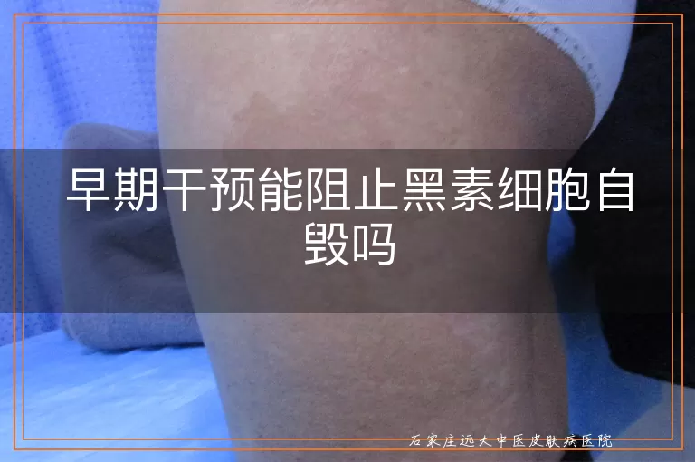 早期干预能阻止黑素细胞自毁吗