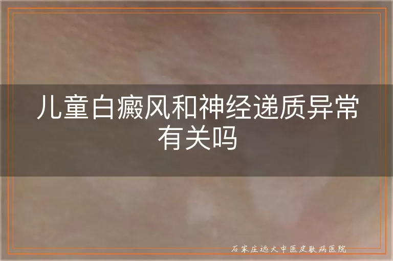 儿童白癜风和神经递质异常有关吗