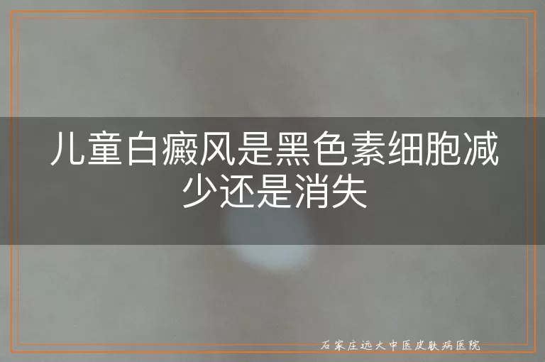 儿童白癜风是黑色素细胞减少还是消失