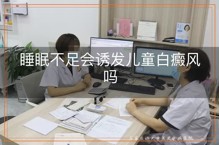 睡眠不足会诱发儿童白癜风吗