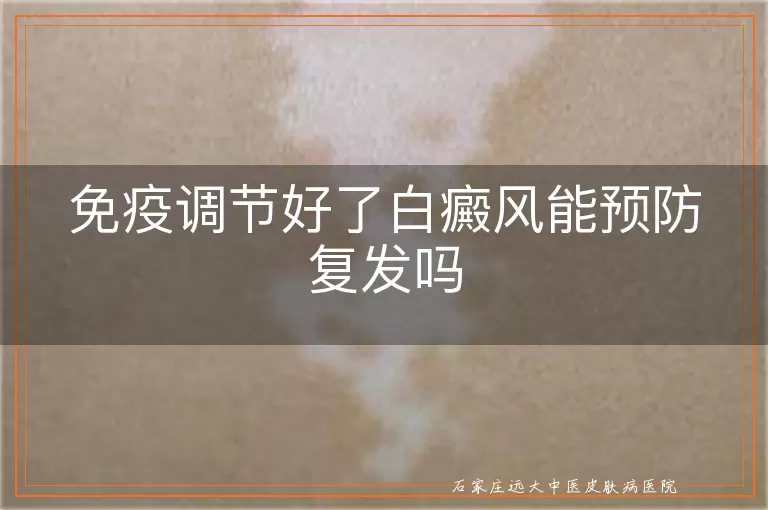 免疫调节好了白癜风能预防复发吗