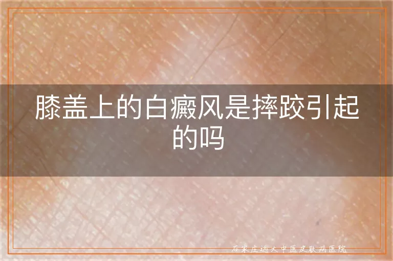 膝盖上的白癜风是摔跤引起的吗