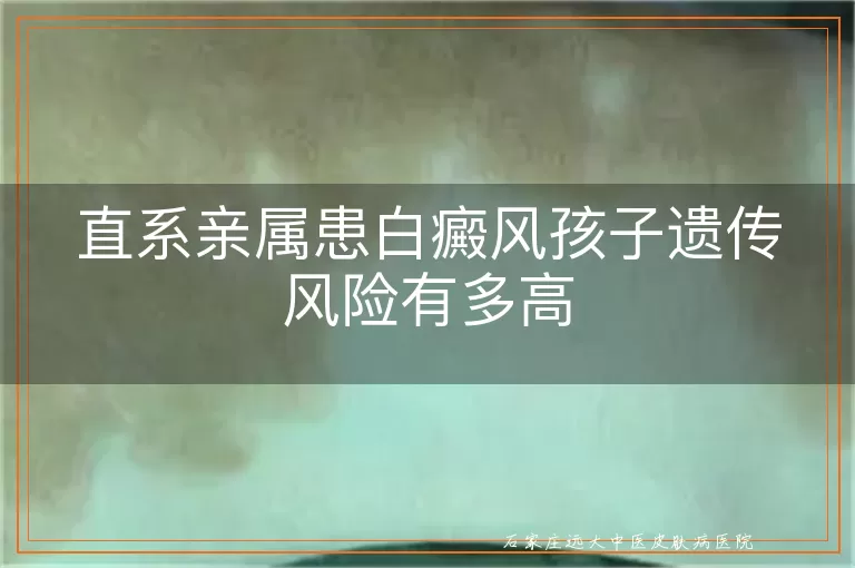 直系亲属患白癜风孩子遗传风险有多高