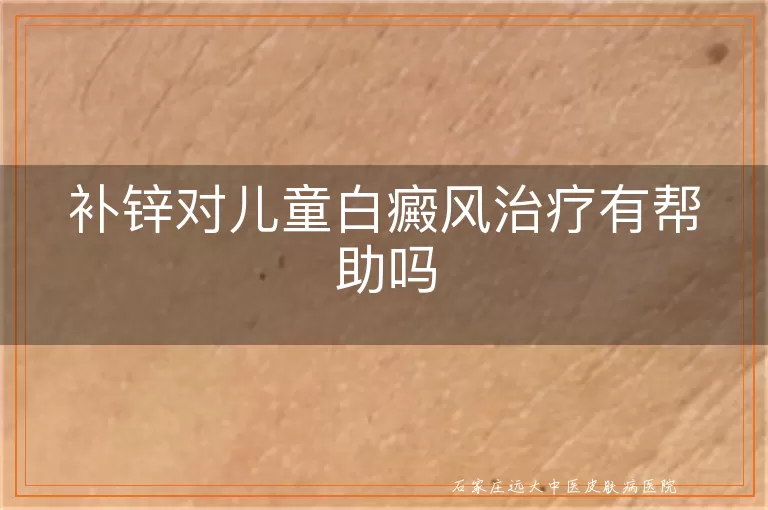 补锌对儿童白癜风治疗有帮助吗