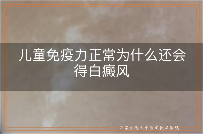 儿童免疫力正常为什么还会得白癜风