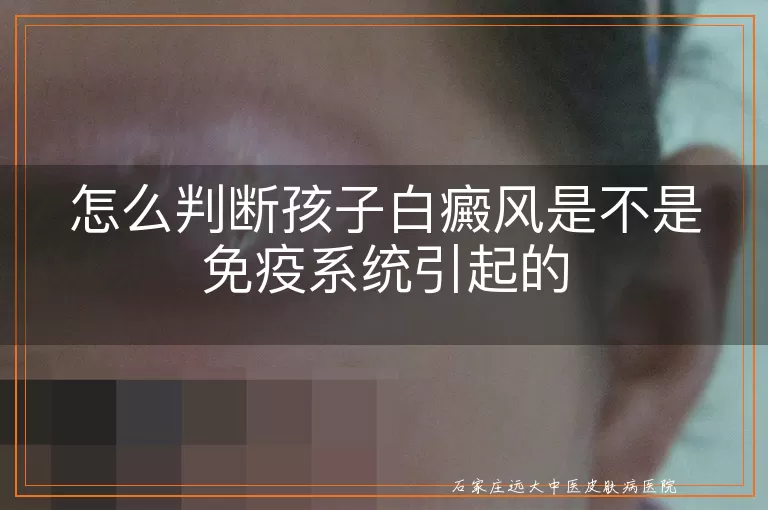 怎么判断孩子白癜风是不是免疫系统引起的