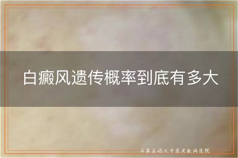 白癜风遗传概率到底有多大