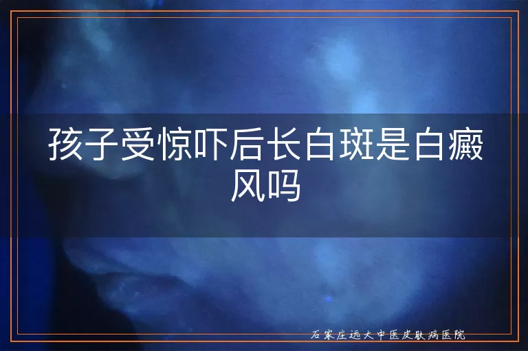 孩子受惊吓后长白斑是白癜风吗