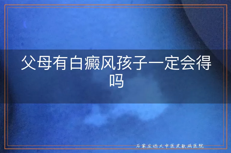 父母有白癜风孩子一定会得吗
