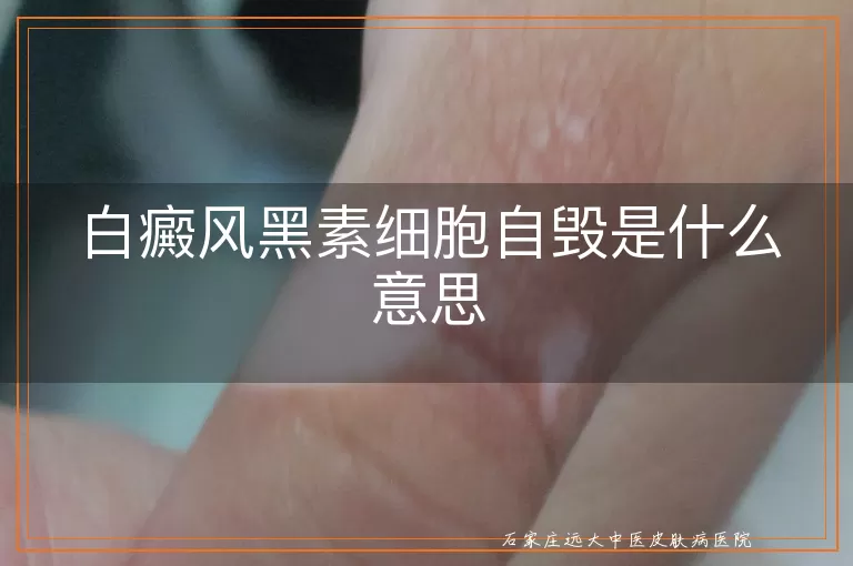 白癜风黑素细胞自毁是什么意思