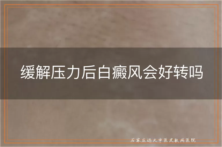 缓解压力后白癜风会好转吗