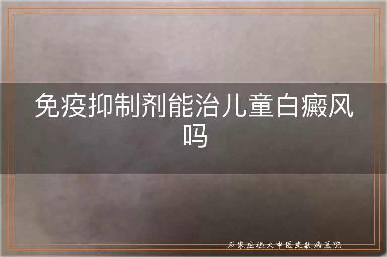 免疫抑制剂能治儿童白癜风吗
