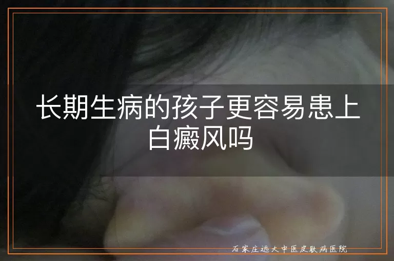 长期生病的孩子更容易患上白癜风吗
