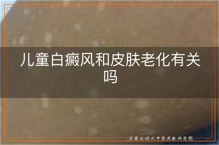 儿童白癜风和皮肤老化有关吗