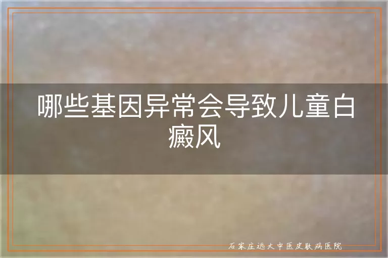 哪些基因异常会导致儿童白癜风