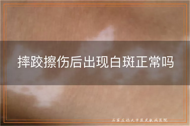 摔跤擦伤后出现白斑正常吗
