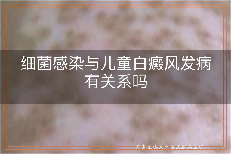 细菌感染与儿童白癜风发病有关系吗