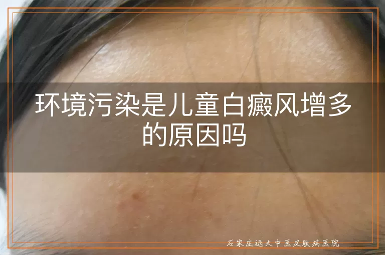 环境污染是儿童白癜风增多的原因吗