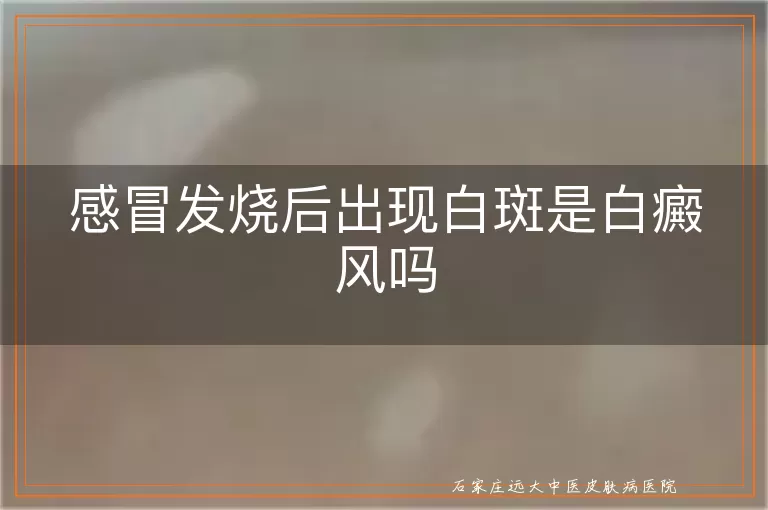 感冒发烧后出现白斑是白癜风吗
