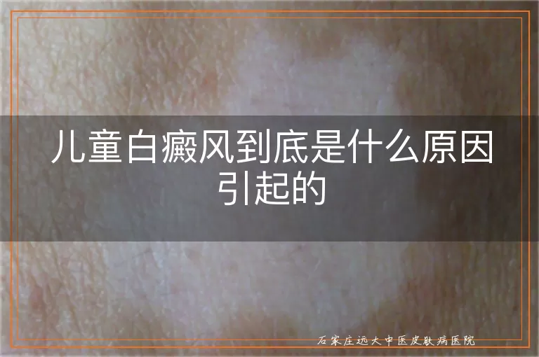 儿童白癜风到底是什么原因引起的