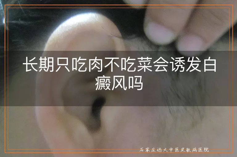 长期只吃肉不吃菜会诱发白癜风吗