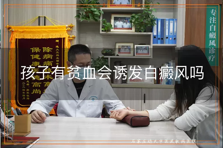 孩子有贫血会诱发白癜风吗