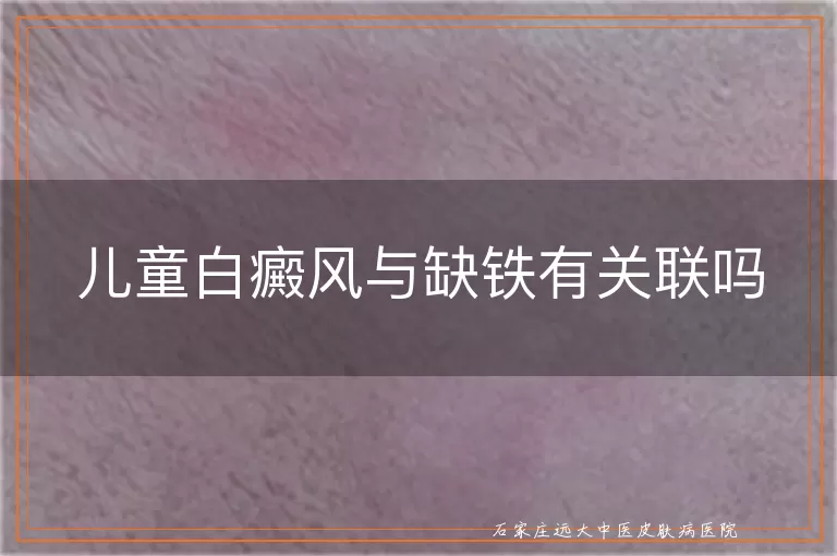 儿童白癜风与缺铁有关联吗