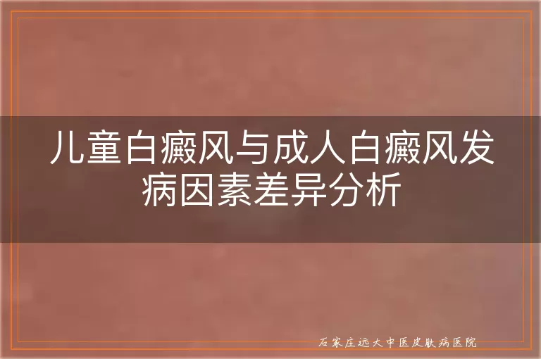 儿童白癜风与成人白癜风发病因素差异分析