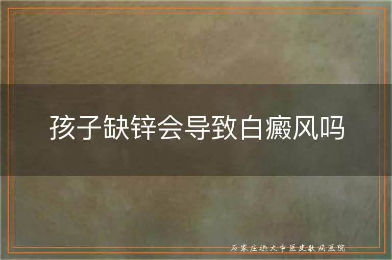 孩子缺锌会导致白癜风吗