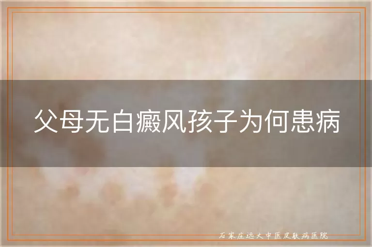 父母无白癜风孩子为何患病