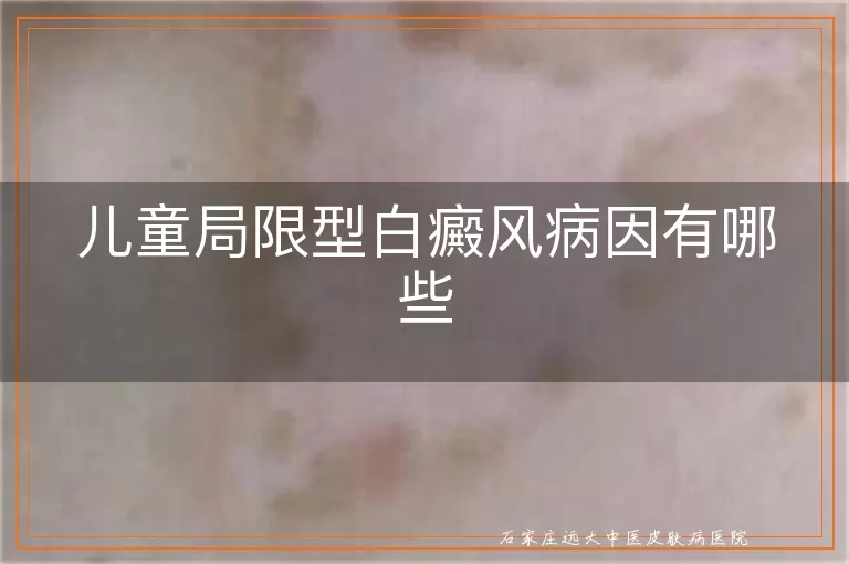 儿童局限型白癜风病因有哪些