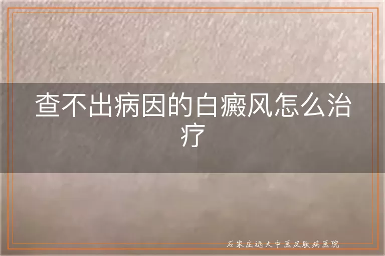 查不出病因的白癜风怎么治疗