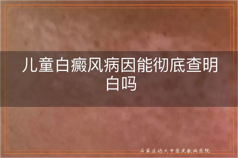 儿童白癜风病因能彻底查明白吗