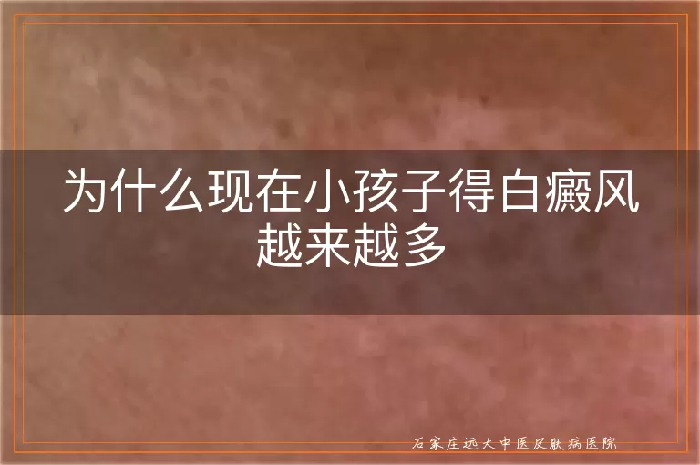 为什么现在小孩子得白癜风越来越多