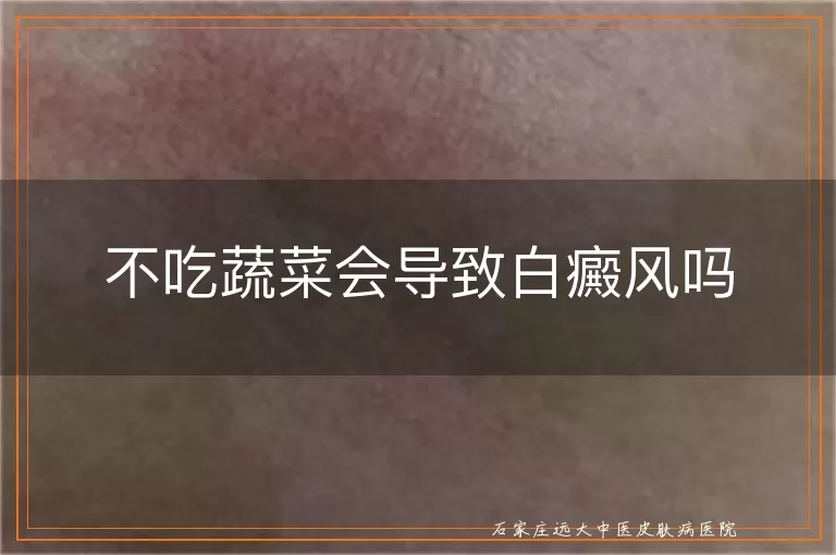 不吃蔬菜会导致白癜风吗