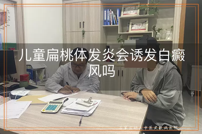 儿童扁桃体发炎会诱发白癜风吗