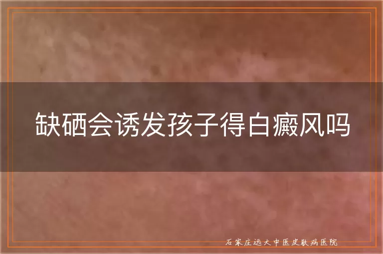 缺硒会诱发孩子得白癜风吗