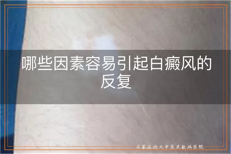 哪些因素容易引起白癜风的反复