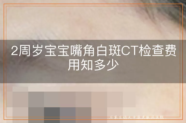 2周岁宝宝嘴角白斑CT检查费用知多少