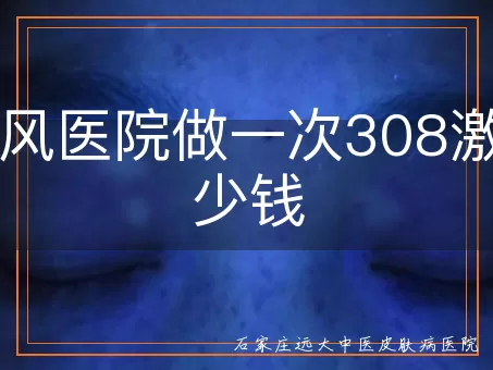 白癜风医院做一次308激光多少钱