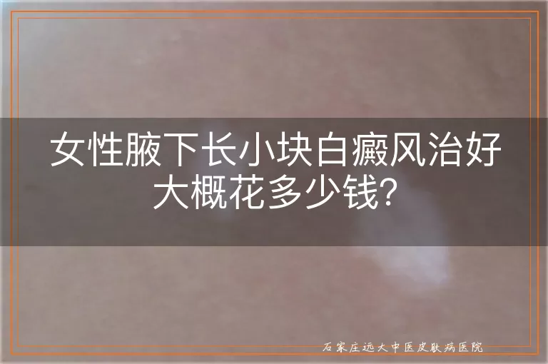 女性腋下长小块白癜风治好大概花多少钱？