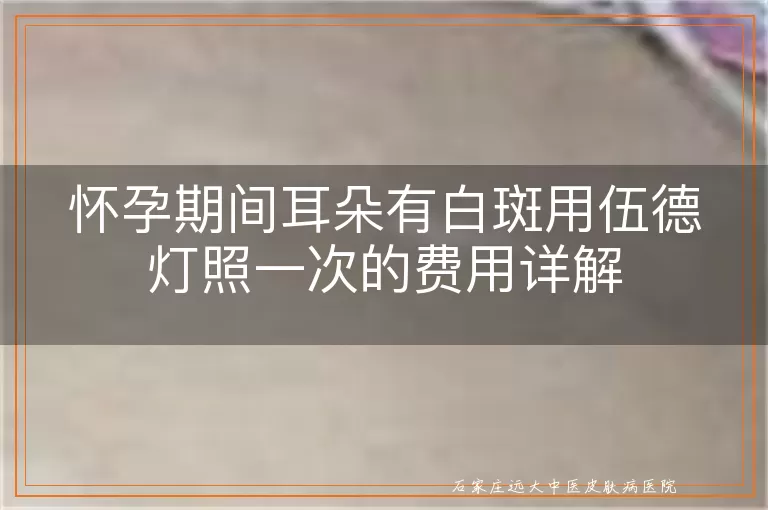 怀孕期间耳朵有白斑用伍德灯照一次的费用详解