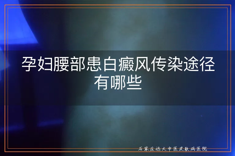 孕妇腰部患白癜风传染途径有哪些