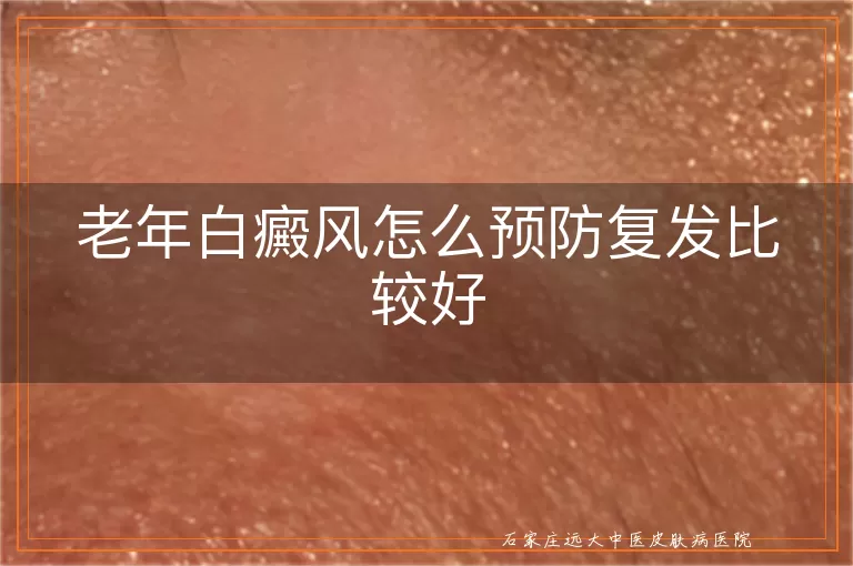 老年白癜风怎么预防复发比较好