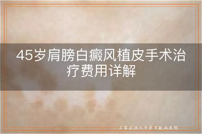 45岁肩膀白癜风植皮手术治疗费用详解