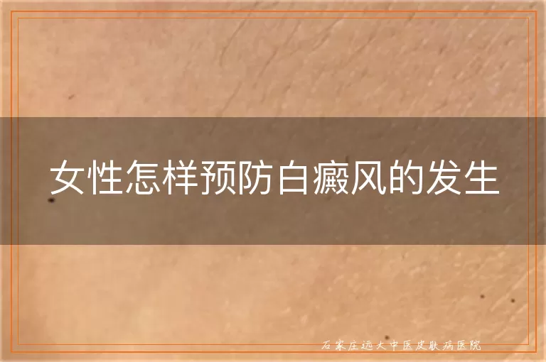 女性怎样预防白癜风的发生
