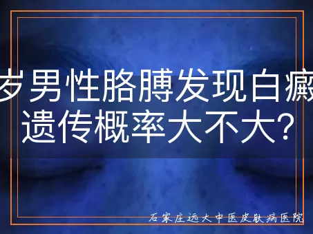 46岁男性胳膊发现白癜风，遗传概率大不大？