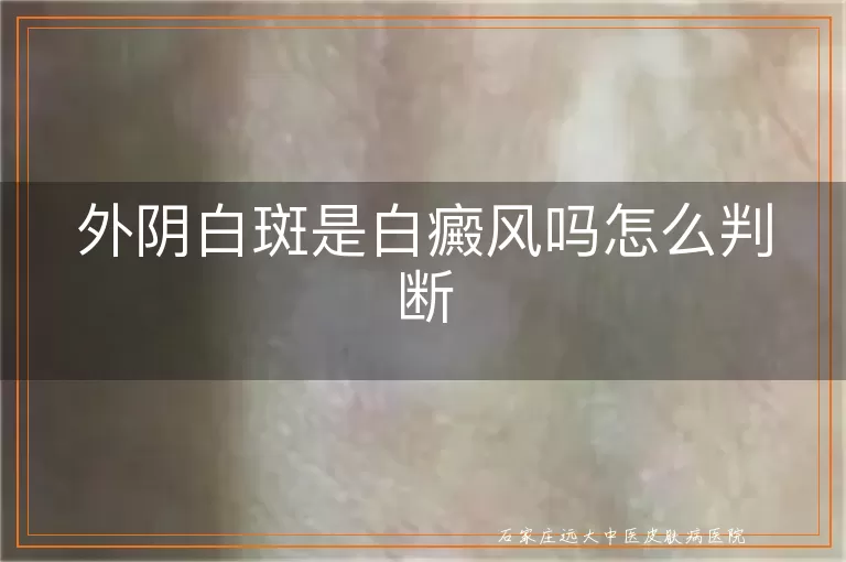 外阴白斑是白癜风吗怎么判断