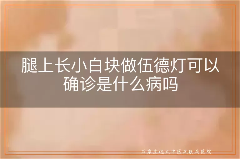 腿上长小白块做伍德灯可以确诊是什么病吗